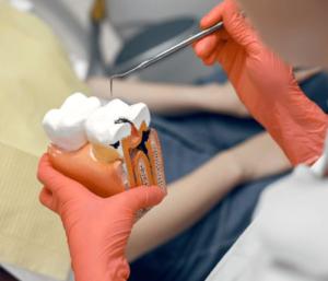 ultimate-guide-cavity-prevention-2025