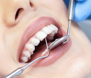 The Truth About Root Canal Treatment: Is It Really Painful?