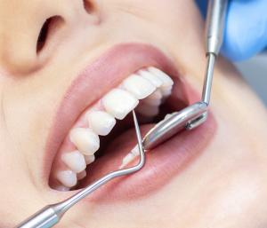 What Makes a Dentist One of the Best Dentists in Bangalore?
