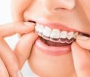 7 Things Your Dentist Wants You to Know Before Getting Dental Implants
