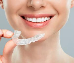 What Happens After Clear Aligner Treatment. Why Retainers Matter